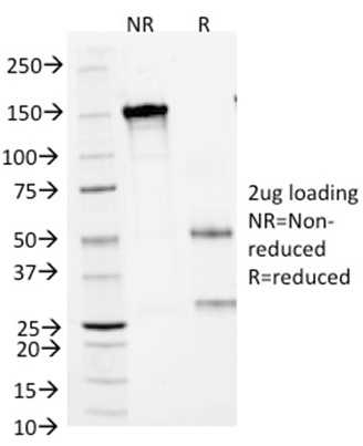Data from SDS-PAGE analysis of Anti-Arginase 1 antibody (Clone ARG1/1125). Reducing lane (R) shows heavy and light chain fragments. NR lane shows intact antibody with expected MW of approximately 150 kDa. The data are consistent with a high purity, intact mAb.